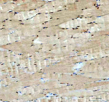 Immunohistochemical staining of FFPE human skeletal muscle tissue with ACSS2 antibody, HRP-secondary and DAB substrate. HIER: boil tissue sections in pH8 EDTA for 20 min and allow to cool before testing.