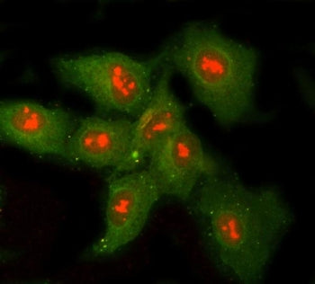 Immunofluorescent staining of FFPE human A549 cells with Ribonuclease H1 antibody (red) and Beta Tub