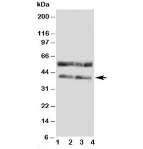CCR5 Antibody