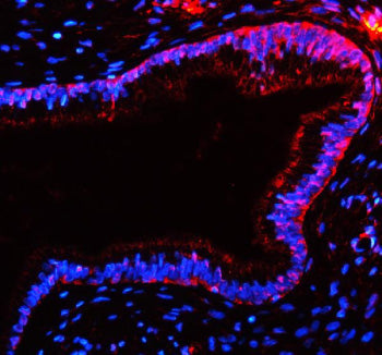 Immunofluorescent staining of TAS2R10 using anti-TAS2R10 antibody (red). TAS2R10 was detected in a p