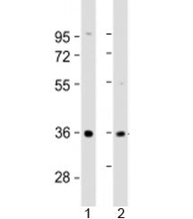 Western blot testing of human 1) liver and 2) SK-BR-3 cell lysate with AKR7A3 antibody at 1:2000. Pr