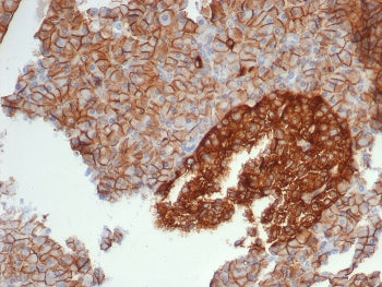 IHC staining of FFPE human pancreas tissue with CD99 antibody (clone MIC2/7861). HIER: boil tissue s
