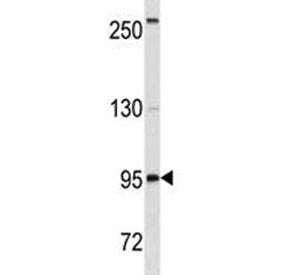 Anti-CD19 antibody western blot analysis in HepG2 lysate. Expected molecular weight: 60~100 kDa