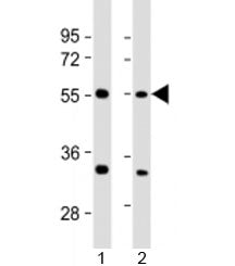 Western blot testing of human 1) 293T/17 and 2) HeLa cell lysate with AAAS antibody at 1:2000. Predi