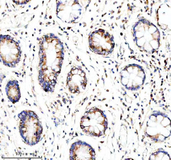 Immunohistochemical staining of GLOD5 using anti-GLOD5 antibody. GLOD5 was detected in a paraffin-em