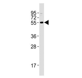 Western blot testing of human HL60 cell lysate with ZFP91 antibody. Predicted molecular weight ~63 k