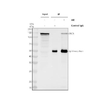 Immunoprecipitating ERC1 in Hela whole cell lysate. Western blot analysis of ERC1 using anti-ERC1 an