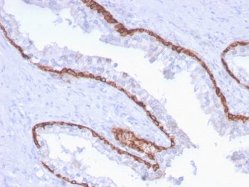 KRT15 Antibody / Cytokeratin 15