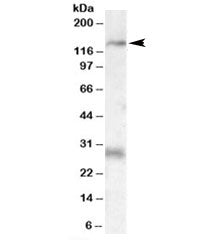 Western blot testing of rat heart lysate with MAP3K6 antibody at 0.3ug/ml. The expected ~140kDa band