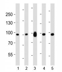 Ephb1 Antibody