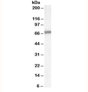 Western blot testing of Jurkat lysate with ABCD4 antibody at 0.3ug/ml. Predicted molecular weight: ~