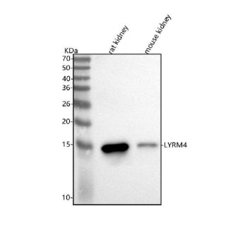 Western blot analysis of LYRM4 using anti-LYRM4 antibody. Lane 1: rat kidney tissue lysates, Lane 2: