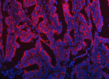 TOM1L1 Antibody / TOM1-like protein 1