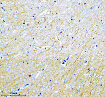 Immunohistochemical staining of MARCKS using anti-MARCKS antibody. MARCKS was detected in a paraffin