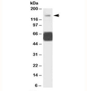 Western blot testing of human cerebellum lysate with GRIK1 antibody at 1ug/ml. Predicted molecular w