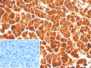Carboxypeptidase A1 Antibody / CPA1