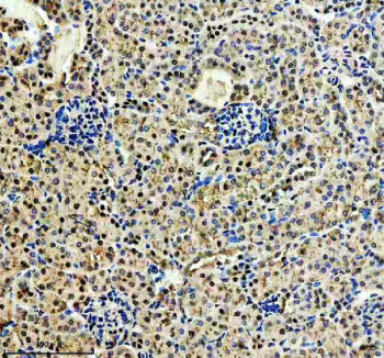 Immunohistochemical staining of CDK2(Phospho-T160)/CDK1(Phospho-T161) using anti-Phospho-CDK2/CDK1 (