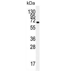 GRP78 Antibody / BiP / HSPA5