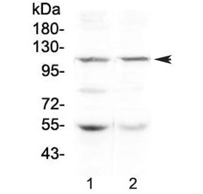 DPYD Antibody