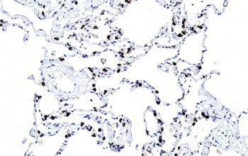 IHC testing of FFPE human lung tissue with SFTPC antibody. HIER: steam section in pH6 citrate buffer
