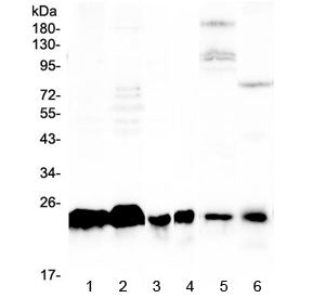 Western blot testing of human 1) A431, 2) K562, 3) U-2 OS, 4) HL60, 5) rat liver and 6) mouse kidney