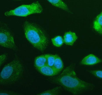 Immunofluorescent staining of FFPE human SiHa cells with NNMT antibody (green) and DAPI nuclear stai