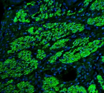 TAGLN Antibody / Transgelin / SM22 alpha