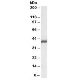 Western blot testing of rat ovay lysate with LIS1 antibody at 0.1ug/ml. Predicted molecular weight: