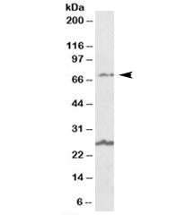 Western blot testing of human olfactory bulb lysate with SLC6A12 antibody at 1ug/ml. The expected ~7