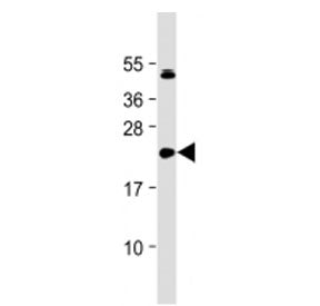 Western blot testing of IL-11 antibody at 1:2000 + human DU145 cell lysate. Predicted molecular weig