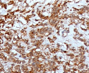 IHC staining of FFPE human liver with CTSK antibody (clone CTO2-1). HIER: boil tissue sections in pH