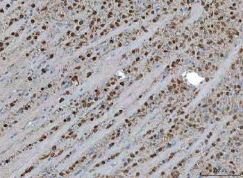 IHC staining of FFPE mouse brain tissue with TSR2 antibody. HIER: boil tissue sections in pH8 EDTA f