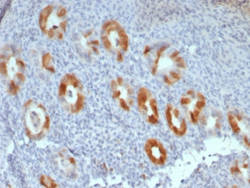 p16INK4a Antibody / CDKN2A