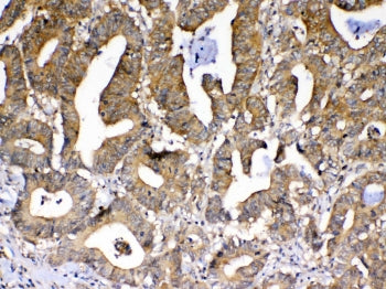 PPID Antibody