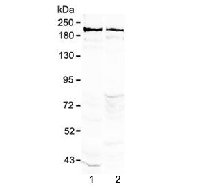 Western blot tesing of rat 1) brain and 2) testis lysate with Neurocan antibody at 0.5ug/ml. Predict