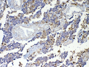 Dnmt1 Antibody