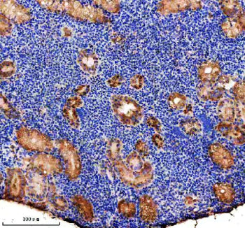Immunohistochemical analysis of P5CS/ALDH18A1 protein using Zebrafish Aldh18a1 antibody and paraffin