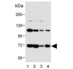 Western blot testing of human 1) K562, 2) MCF7, 3) HepG2 and 4) A431 cell lysate with Acid Sphingomy