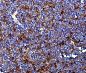 IHC staining of FFPE mouse Peyer's patches with Rad17 antibody. HIER: boil tissue sections in pH8 ED