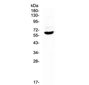 Western blot testing of mouse spleen lysate with Heparanase antibody at 0.5ug/ml. Predicted molecula