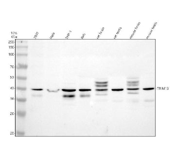 Western blot analysis of TRIM13 using anti-TRIM13 antibody. Electrophoresis was performed on a 10% S