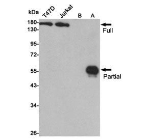 Western blot testing of lysates from human T47D, Jurkat, untransfected CHO-K1(B) and CHO-K1 transfec