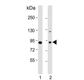 Western blot testing of human 1) brain and 2) MCF7 cell lysate with MAPK8IP1 antibody. Expected mole