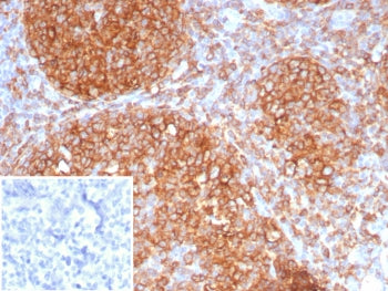 IHC staining of FFPE human tonsil tissue with HLA-DR antibody (clone HLA-DRA/8286R). Inset: PBS used