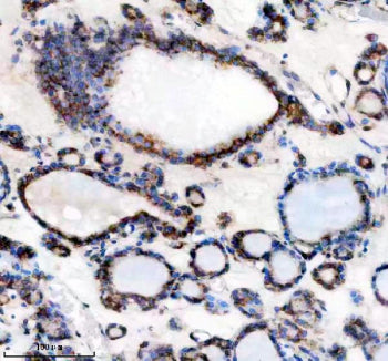 IHC analysis of TMED10 using anti-TMED10 antibody. TMED10 was detected in a paraffin-embedded sectio
