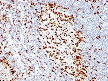 ZAP70 Antibody