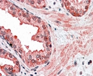 IHC testing of FFPE human prostate with CCNDBP1 at 4ug/ml. HIER: steamed with pH6 citrate buffer, AP