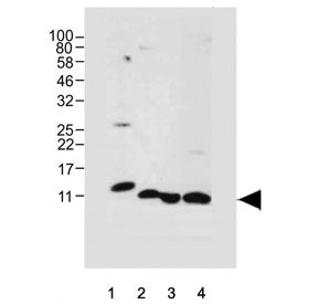 Western blot testing of human 1) pancreas, 2) PANC-1, 3) U-2 OS and 4) A431 cell lysate with REG3A a