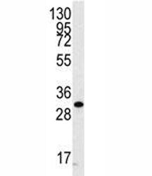 Western blot analysis of CDC2 antibody and A2058 cell lysate. Predicted molecular weight ~34 kDa.