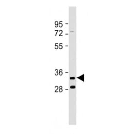 Western blot testing of TMEM106B antibody at 1:2000 + mouse brain lysate. Predicted molecular weight